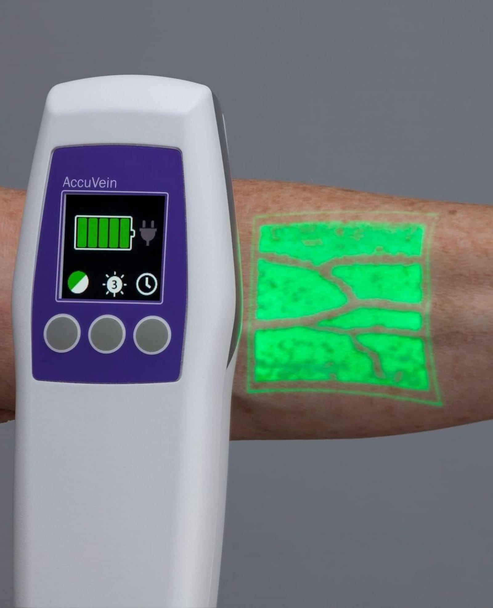 Donazione AccuVein Ospedale Salerno