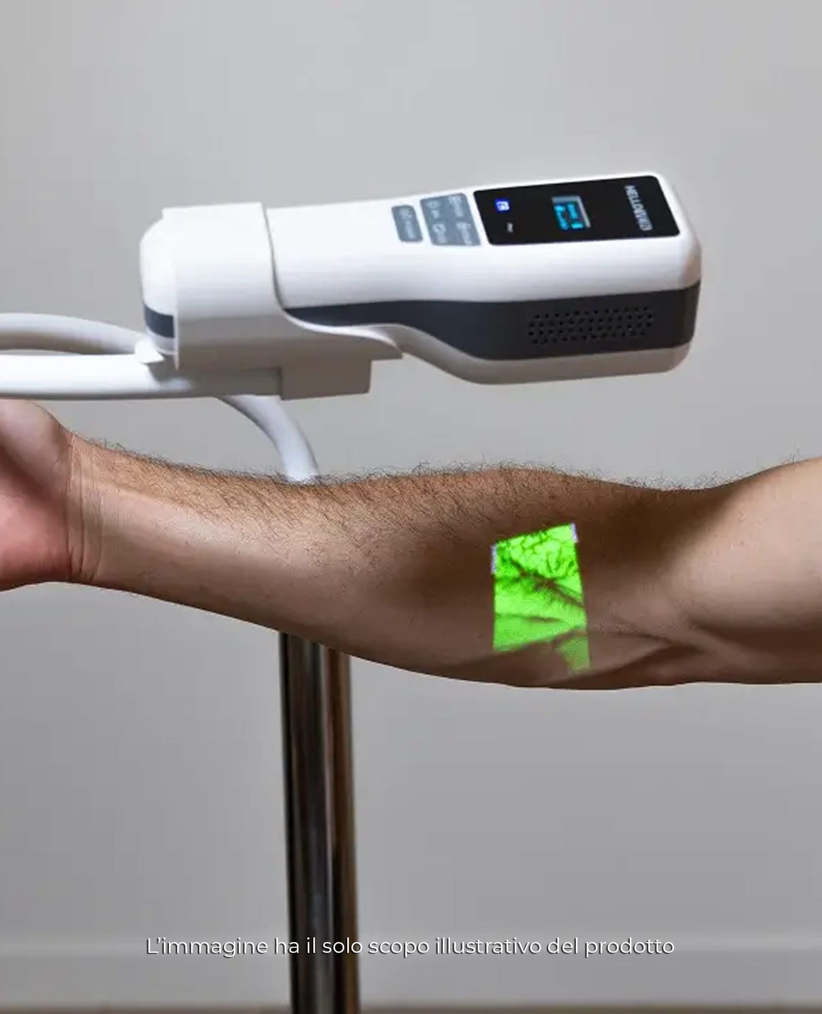 Donazione Un dispositivo per prelievi più sicuri e meno dolorosi per Ospedale Milazzo